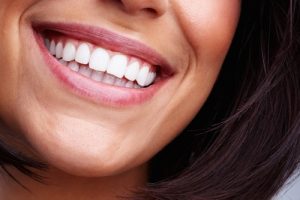 bright white smile